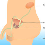 Rakovina prostaty